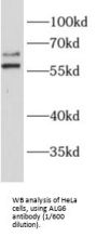ALG6, Alpha-1,3-Glucosyltransferase (ALG6) Antibody