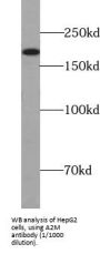Alpha-2-Macroglobulin (A2M) Antibody