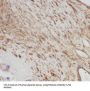 5'-AMP-Activated Protein Kinase Subunit Gamma-2 (AMPK gamma 2) Antibody