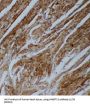 Angiopoietin 2 (ANGPT2) Antibody