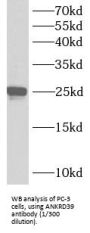 Ankyrin Repeat Domain 39 (ANKRD39) Antibody
