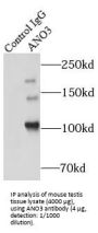 Anoctamin 3 (ANO3) Antibody