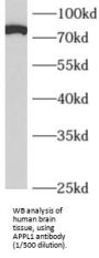DCC-Interacting Protein 13-Alpha (APPL1) Antibody