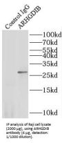 Rho GDP-Dissociation Inhibitor 2 (ARHGDIB) Antibody