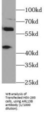 ADP-Ribosylation Factor-Like 13B (ARL13B) Antibody
