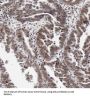 ADP-Ribosylation Factor-Like Protein 2 (ARL2) Antibody