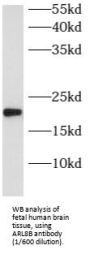 ADP-Ribosylation Factor-Like Protein 8B (ARL8B) Antibody
