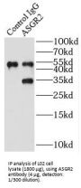 Asialoglycoprotein Receptor 2 (ASGR2) Antibody
