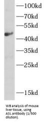 Argininosuccinate Lyase (ASL) Antibody