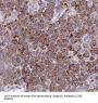 Argininosuccinate Lyase (ASL) Antibody