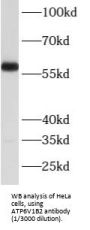 V-Type Proton ATPase Subunit B, Brain Isoform (ATP6V1B2) Antibody