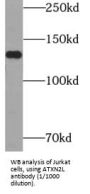 Ataxin-2-Like Protein (ATXN2L) Antibody