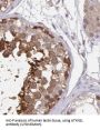 Ataxin-2-Like Protein (ATXN2L) Antibody