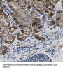 5-Azacytidine-Induced Protein 2 (AZI2) Antibody