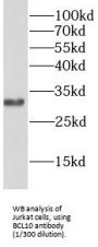 B-Cell Lymphoma/leukemia 10 (BCL10) Antibody
