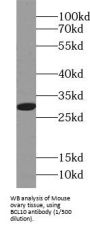B-Cell Lymphoma/leukemia 10 (BCL10) Antibody
