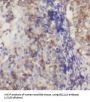 B-Cell Lymphoma/Leukaemia 11A (BCL11A) Antibody