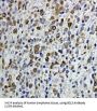 B-Cell CLL/Lymphoma 3 (BCL3) Antibody