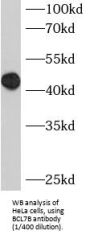 B-Cell CLL/Lymphoma 7B (BCL7B) Antibody
