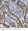 Protein-Tyrosine Kinase 6 (PTK6) Antibody