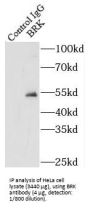 Protein-Tyrosine Kinase 6 (PTK6) Antibody