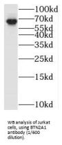 Butyrophilin Subfamily 2 Member A1 (BTN2A1) Antibody