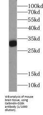 Calbindin (CALB1) Antibody