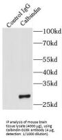 Calbindin (CALB1) Antibody