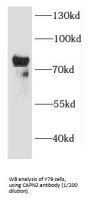 Calpain 2 (CAPN2) Antibody