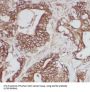 Calpain 2 (CAPN2) Antibody