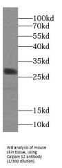 Calpain S2 Antibody