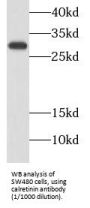 Calretinin (CALB2) Antibody