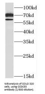 Coiled-Coil Domain-Containing Protein 55 (CCDC55) Antibody