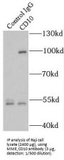 Neprilysin / NEP (MME) Antibody