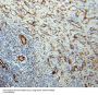 Melanoma Cell Adhesion Molecule (MCAM) Antibody