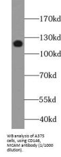 Melanoma Cell Adhesion Molecule (MCAM) Antibody