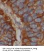 Melanoma Cell Adhesion Molecule (MCAM) Antibody