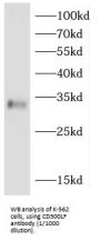 CMRF35-Like Molecule 1 / IREM1 (CD300LF) Antibody
