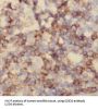 Cluster of Differentiation 320 (CD320) Antibody