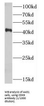 Cyclin Dependent Kinase 9 (CDK9) Antibody