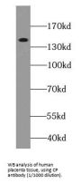 Ceruloplasmin (CP) Antibody