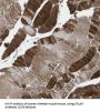 CFLAR / FLIP Antibody