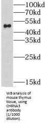 Cholinergic Receptor, Nicotinic Alpha 3 (CHRNA3) Antibody