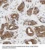 Cholinergic Receptor, Nicotinic Alpha 3 (CHRNA3) Antibody