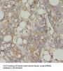Cholinergic Receptor, Nicotinic Beta 1 (CHRNB1) Antibody
