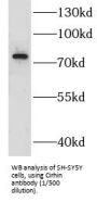 U3 Small Nucleolar RNA-Associated Protein 4 Homolog (UTP4) Antibody