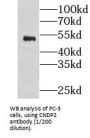 Cytosolic Non-Specific Dipeptidase (CNDP2) Antibody
