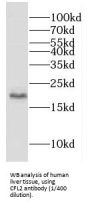 Cofilin 2 (CFL2) Antibody