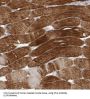 Cofilin 2 (CFL2) Antibody