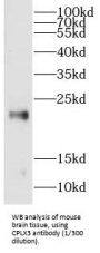 Complexin-3 (CPLX3) Antibody